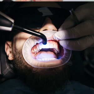 5 Benefits of Professional Teeth Whitening