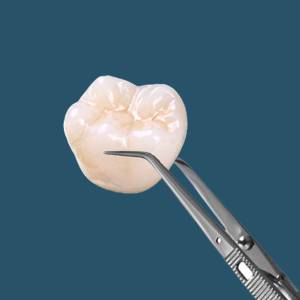 5 Different Types of Dental Crowns Available in Newark 5 Different Types of Dental Crowns Available in Newark