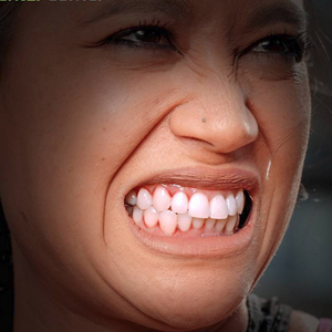 5 Reasons Behind Bleeding Gums 5 Reasons Behind Bleeding Gums