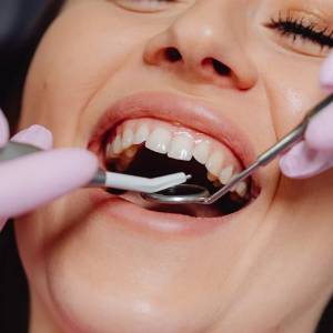 5 Most Widely Known Factors That Lead to Tooth Extractions in Newark | Newark 5 Most Widely Known Factors That Lead to Tooth Extractions in Newark