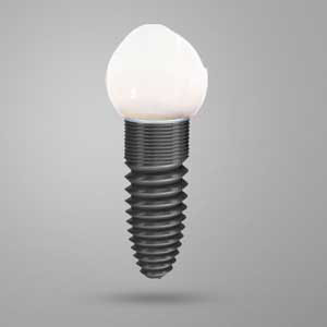 5 Tips for Looking After Your Dental Implants in Newark 5 Tips for Looking After Your Dental Implants in Newark