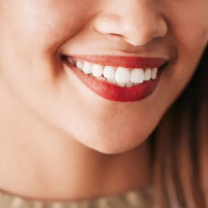 Aftercare Tips for the Success of Teeth Whitening in Newark Aftercare Tips for the Success of Teeth Whitening in Newark