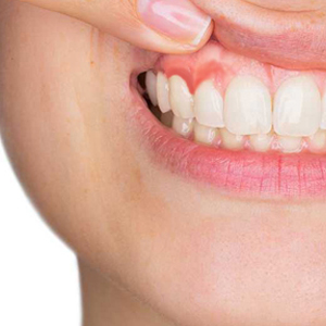 Can We Have Dental Implants With Periodontist? Can We Have Dental Implants With Periodontist?
