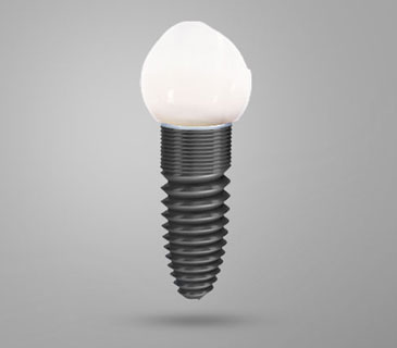 The Effects of Dental Implants on Oral Health | Newark The Effects of Dental Implants on Oral Health
