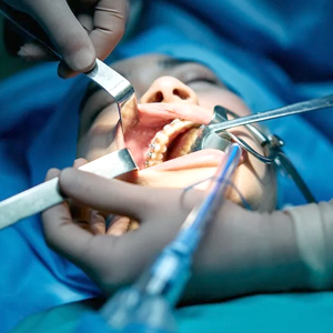 Essential Guide: Why Do You Need an Oral Surgeon in Newark Essential Guide: Why Do You Need an Oral Surgeon in Newark