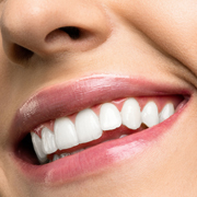 How To Prepare For Teeth Whitening? How To Prepare For Teeth Whitening?