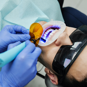 Teeth Whitening: The Preferred Procedure By Cosmetic Dentists