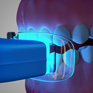 Is Teeth Whitening Treatment Painful? Is Teeth Whitening Treatment Painful?